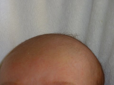 P-ko chan's hairline.