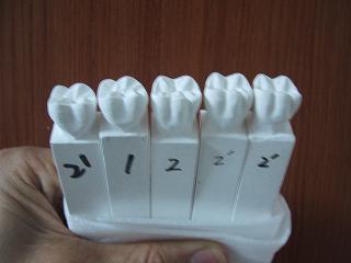 普通石膏 等倍大 歯型彫刻6本 普通石膏 等倍大 歯型彫刻6本 普通石膏 等倍大 歯