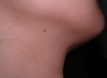 リバイタリフトモニター