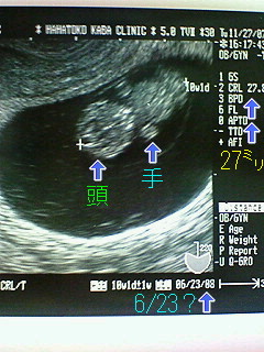 200711271940000.jpg