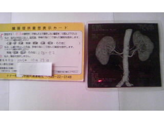 臓器提供意思表示カードと腎様プロマイド.jpg