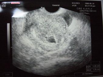 5w2d