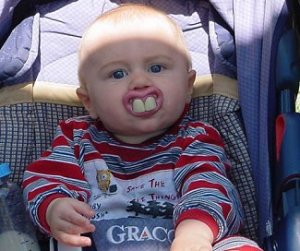 おもしろ画像 出っ歯の赤ちゃん さすらいの若旦那の日記 楽天ブログ