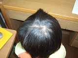 つむじ