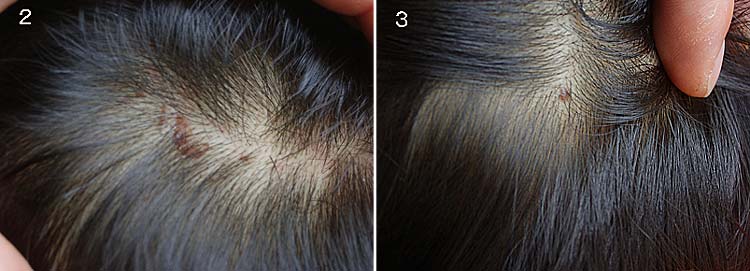 事故4日後の写真　　20070415