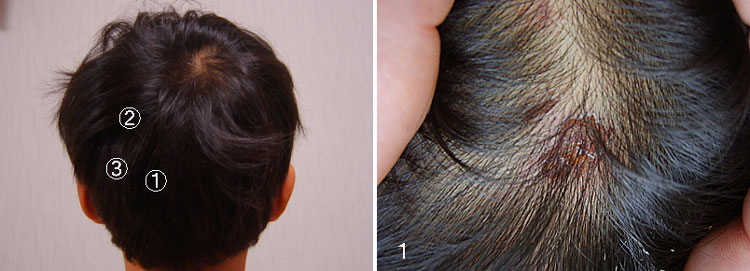 事故4日後の写真　　20070415