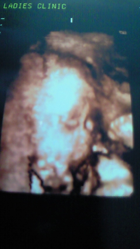 30週目★おかお