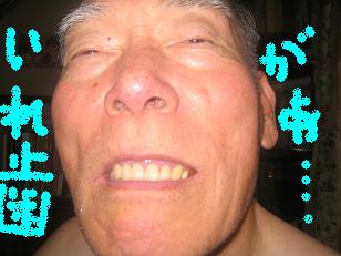 入れ歯が・・・