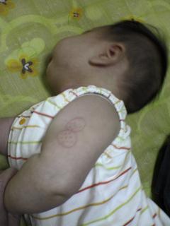 ねねちゃん　BCG　３ヶ月