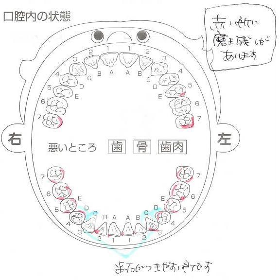 歯科検診結果