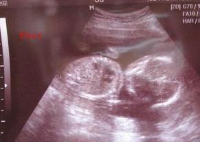 17w4d.JPG