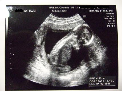 妊娠17週 妊婦健診へ よだきん坊のブログ 楽天ブログ