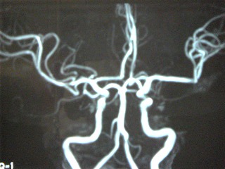 Image0521　脳血管.jpg
